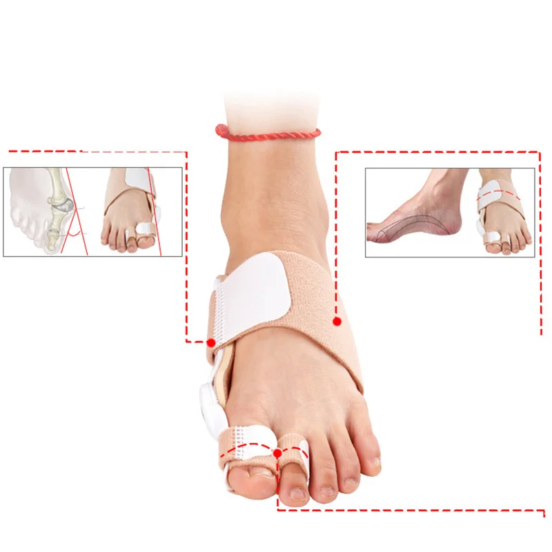 1PC Thumb Valgus Toe Separator Hallux Double Hole Correction Belt Day and Night Use | Красота и здоровье