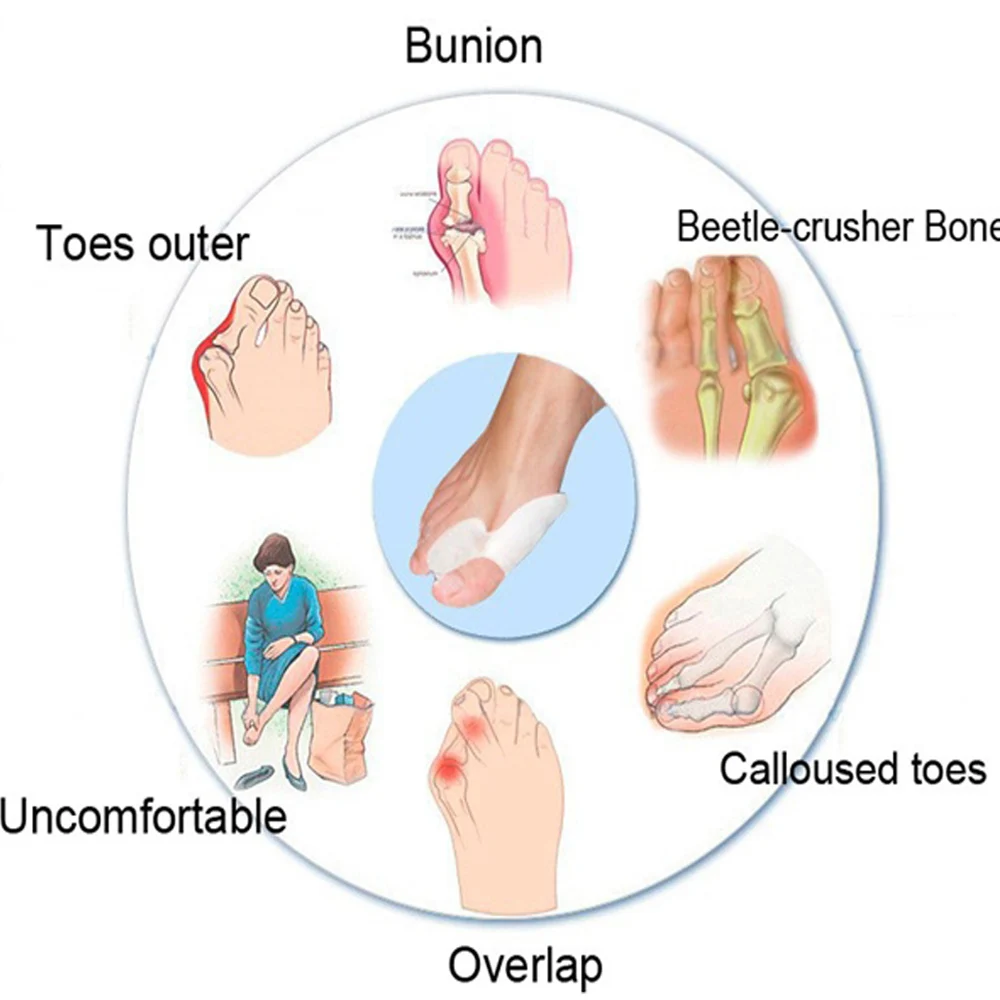 Уход за ногами силиконовый Seperator для ног корректор Bunion вальгус большая коррекция