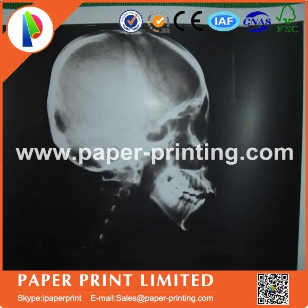 4 рулона высококачественной глянцевой ультразвуковой бумаги UPP 110 рт. Ст. мм