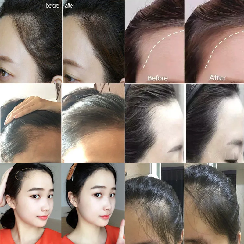 Hair Line Shadow Powder, Root Concealer, Fluffy Thin Hair Makeup, Instant Gray Coverage, 4g image 4