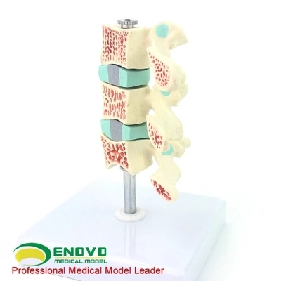 skeleton model Intervertebral disc Human lumbar model free shipping