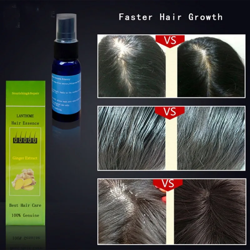 Manooby экстракт имбиря для роста волос натуральный продукт против выпадения