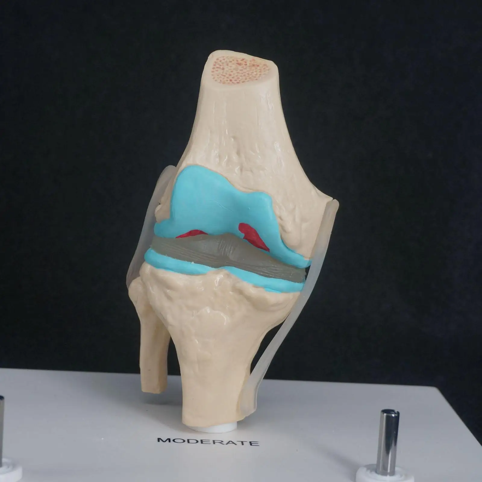 Анатомическая модель человека для дегенеративных заболеваний коленных суставов