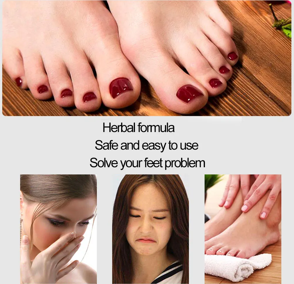 3 шт. дезодорирующий крем от псориаза дерматит экзема знойный запах травяной