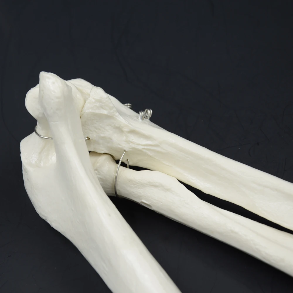 1:1 модель костей человека рука взрослого и радиус верхней конечности|human bone|bone