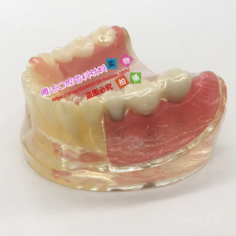 

human model Dental model Comprehensive pathology detachable Implant repair crystal free shipping
