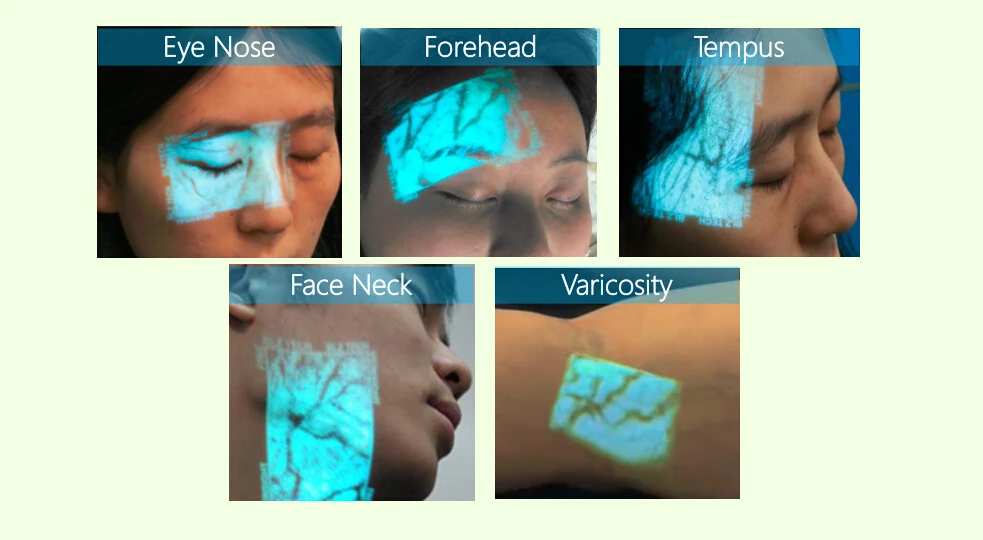 Портативный прибор для измерения венозных сосудистых звездочек инфракрасный