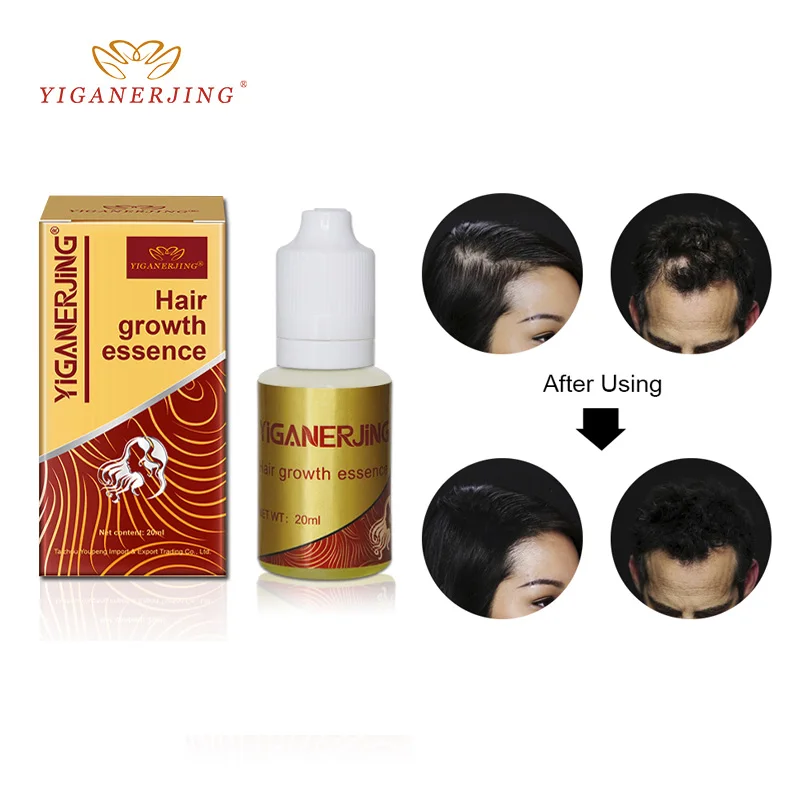 

Ginger Extract Dense Hair Fast Sunburst Growth Essence Restoration ,YIGANERJING Care Oil Liquid Serum For Hair Loss(20ml)