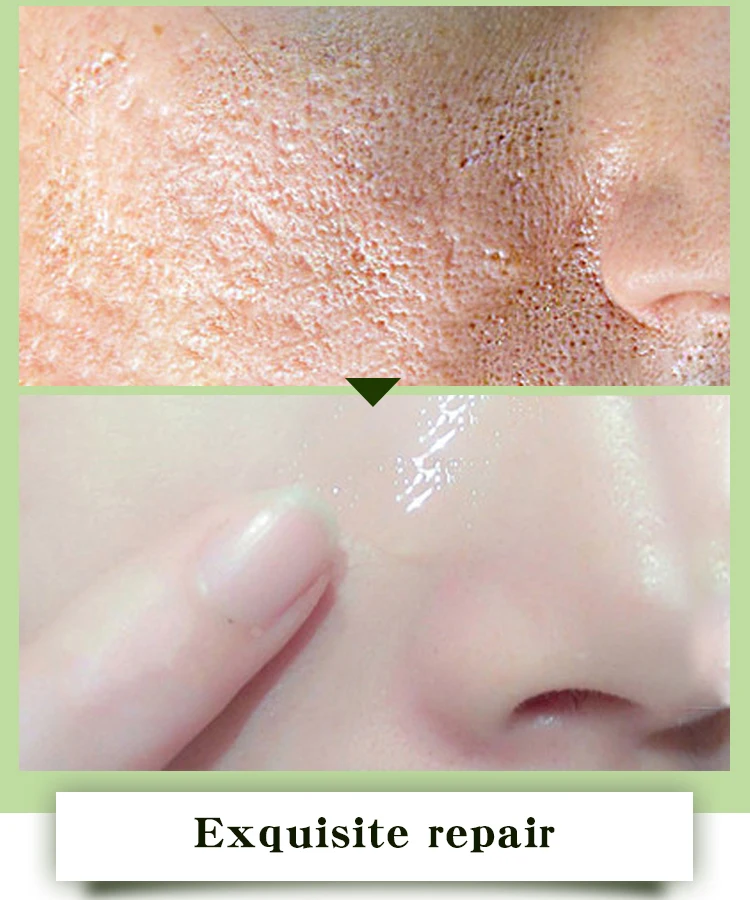 MABREM Pomegranate Fine Pores Face Serum Whitening Plant Skin Care Anti Aging Anti Wrinkle Cream Reduce Acne Marks Care 10ml