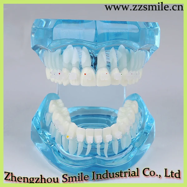 Фотообои с фонариком M3002|dental model study|model dentaldental orthodontics |