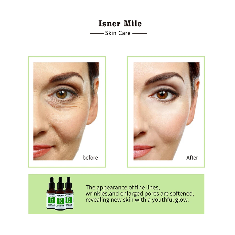 Vitamin C face Serum Hyaluronic Acid Whitening Anti-Aging Fade Spots Removing Freckle Anti Winkles Moisturizing Face Cream Care