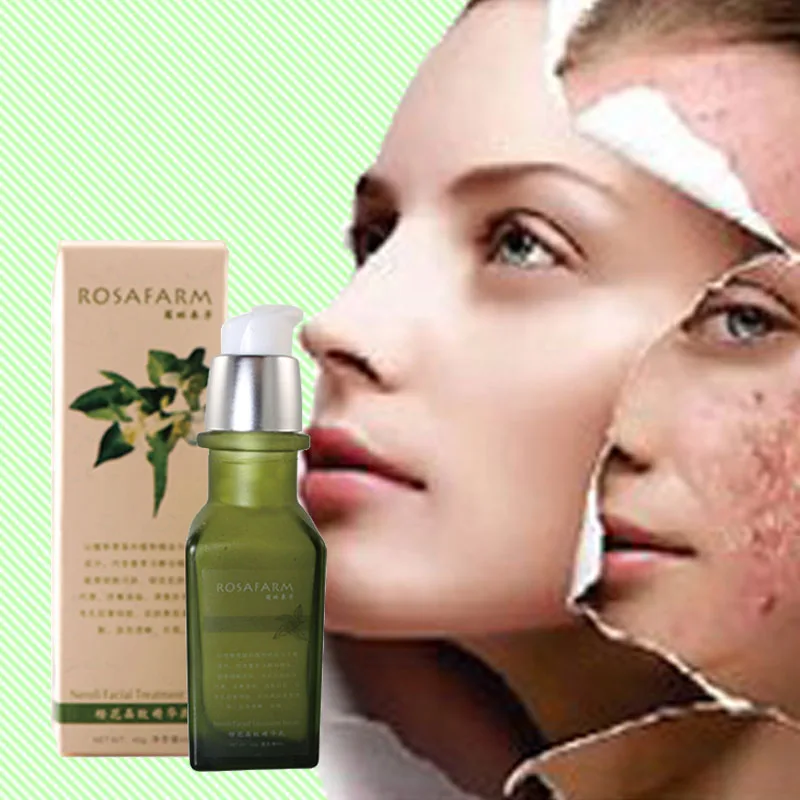 Эссенция для отбеливания и борьбы с прыщами 40 г|essence|essence 4 |