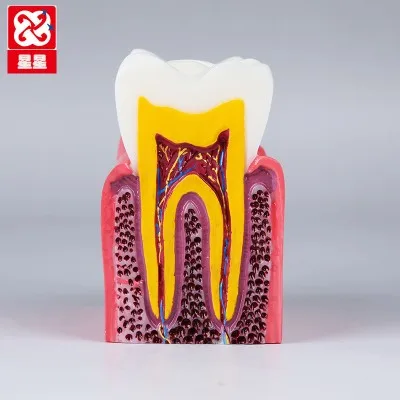 

6X кариесы, сравнение моделей, мономер для связи с пациентом, Расширительная модель, бесплатная доставка