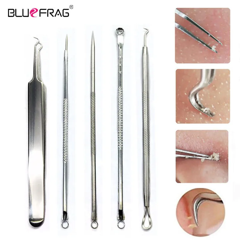 Tweezers Blackhead Remover Tool Stainless Steel Tools Comedone Acne Extractor Tweezer Pimple Removal Needles set | Красота и здоровье