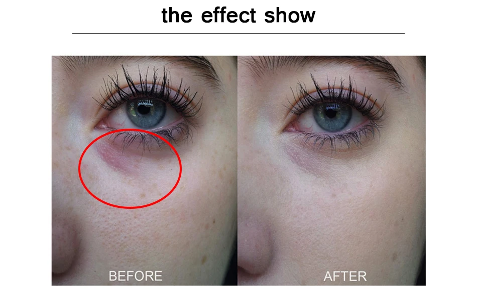 OMY LADYFacial Anti Wrinkle Face Cream Lifting Firming Whitening Moisturizing Skin Care Repair Treatment Freckle Removal beauty