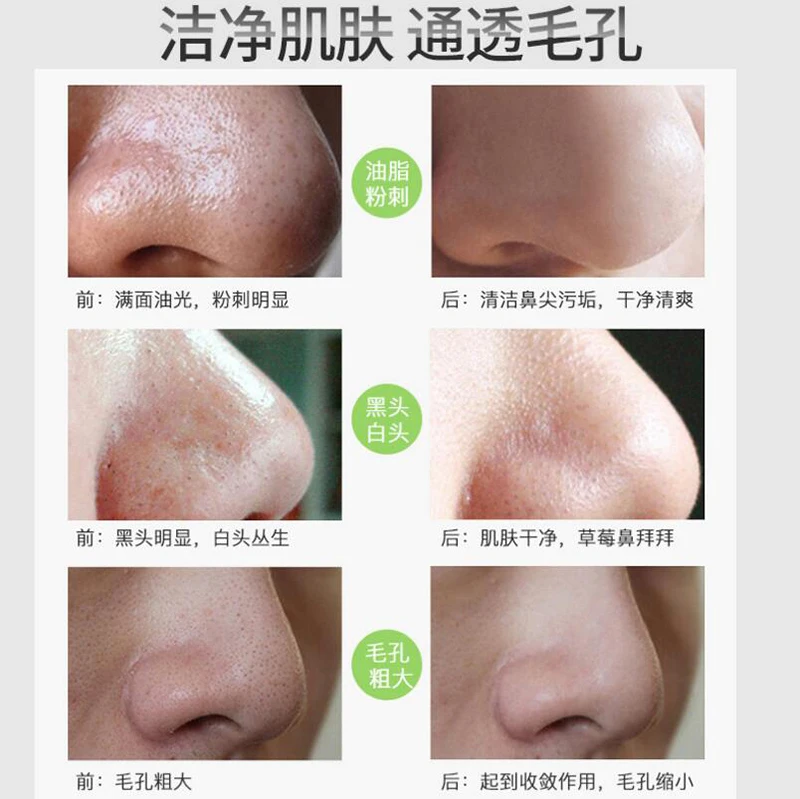 Изображения уход за лицом бамбуковая маска для носа с древесным углем Удаление