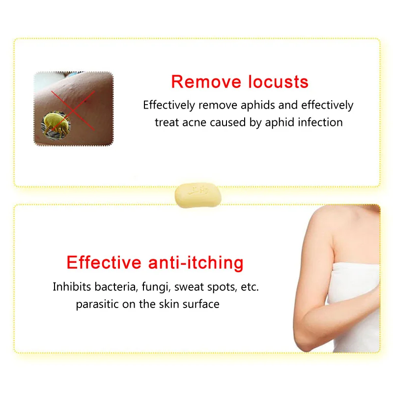 85 г Шанхай сернистое Мыло Уход за кожей дерматит гриб эцема против бактерий