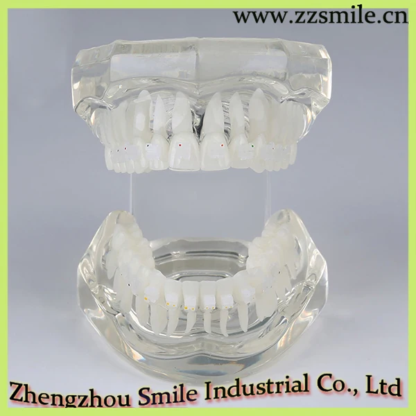 Фотообои с фонариком M3002|dental model study|model dentaldental orthodontics |
