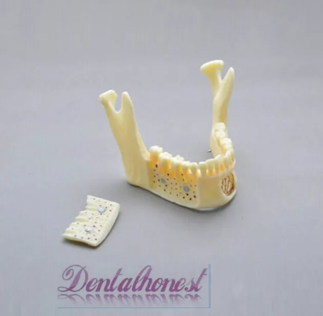 Dentalmall Стоматологическая модель #5004 02 Съемная профессиональная