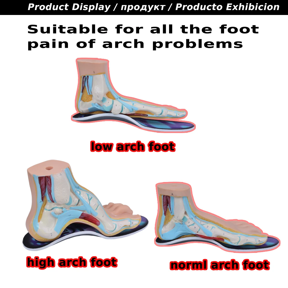 EXPfoot Premium Orthotic Gel High Arch Support Insole Gel Pad 3D Arch Support Flat Foot orthopedic Foot pain For Women  Men 452