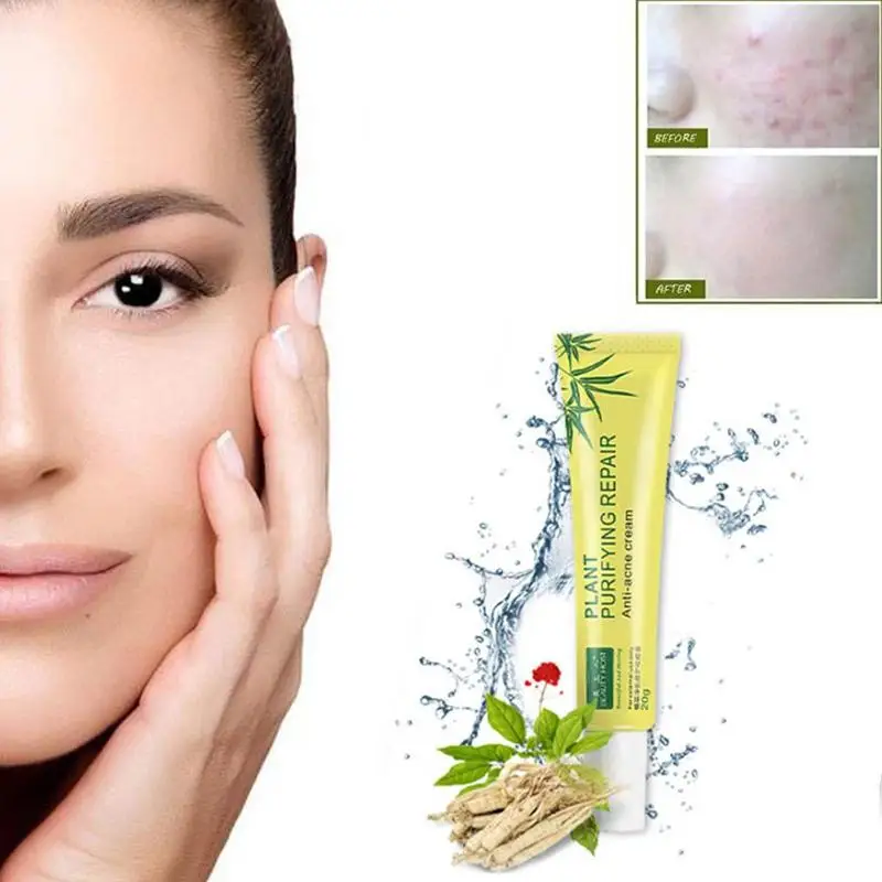 Крем для удаления прыщей и рубцов крем восстановления кожи уход за кожей лица