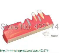 

Free Shipping Implant demonstration model dental tooth teeth dentist anatomical anatomy model odontologia