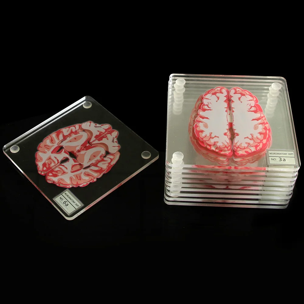 Мозговые образцы подставки набор 3D органные мозговые работы мозговые ломтики квадратная акриловая стеклянная подставка под стол для напитков подарок пьянским учёным