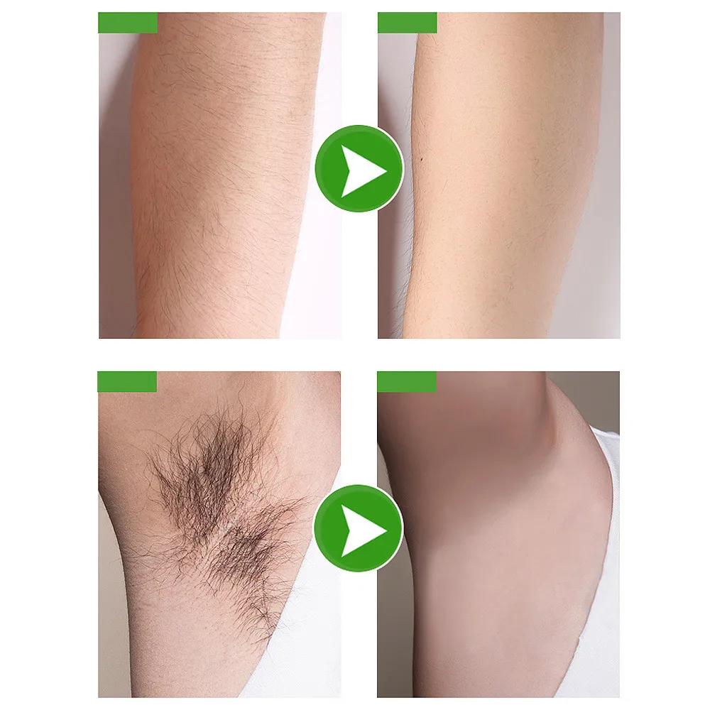 

Magic Painless 1Pcs No Damage No Pain Anti allergic Mousse Spray Foam Mousse Creams Depilatories For Both Women And Men