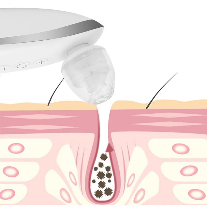 Blackhead Remover Vacuum Pore Acne Pimple FY-200G Removal Suction Tool Electric Facial Cleaner Skin Care |