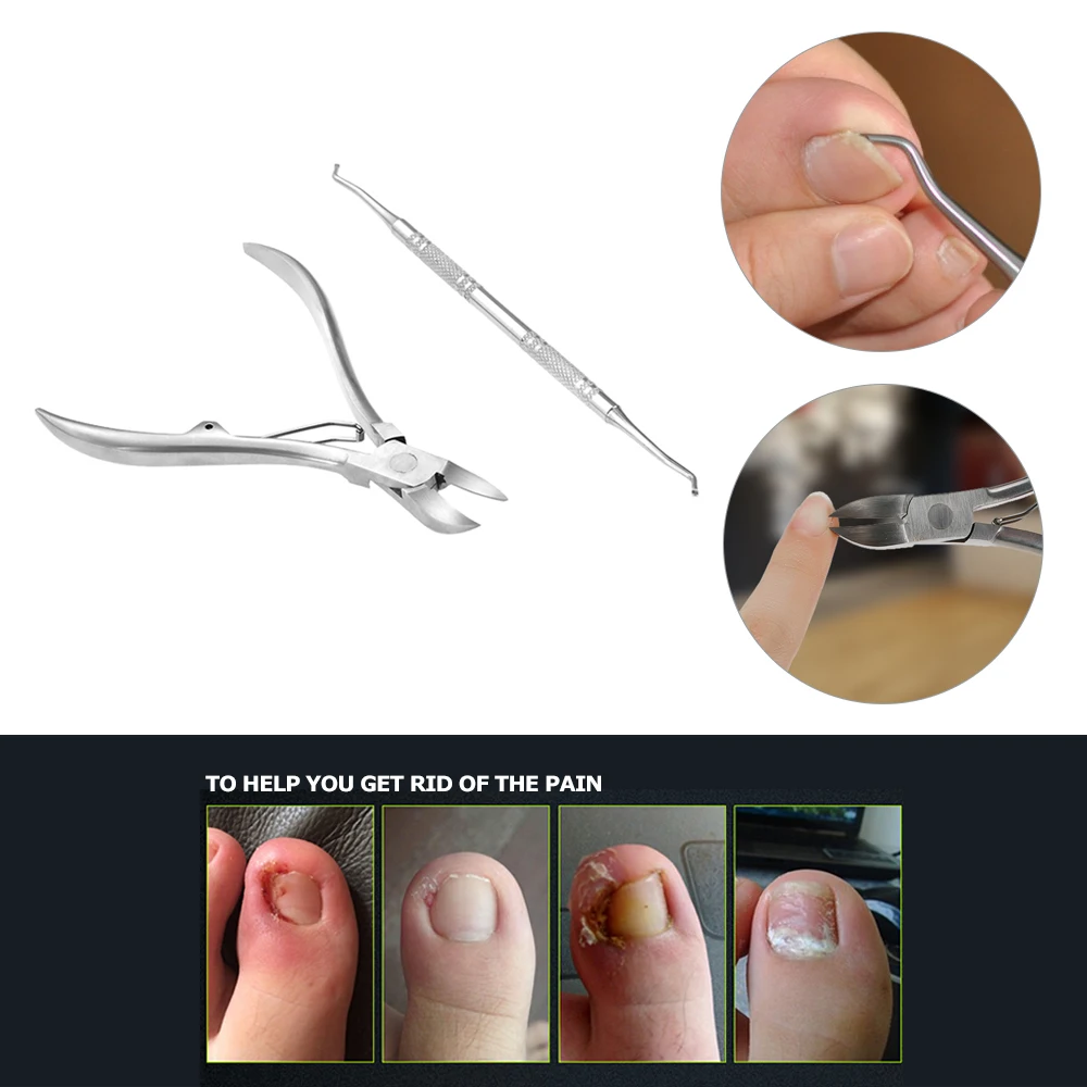 2pcs Stainless Steel Nail Cuticle Scissor + Ingrowing Toenail Cleaner Clippers Nipper Manicure Pedicure Tool | Красота и здоровье