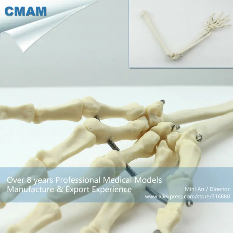 CMAM/12358 кость для верхней конечности медицинская анатомическая человеческая