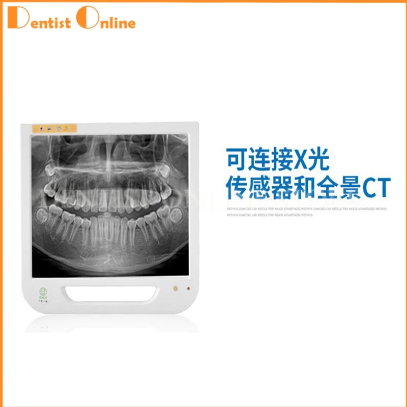 

International popular Dental 5 million pixels, WiFi Touch the Oral Camera 17 "Computer Implant Intraoral camera