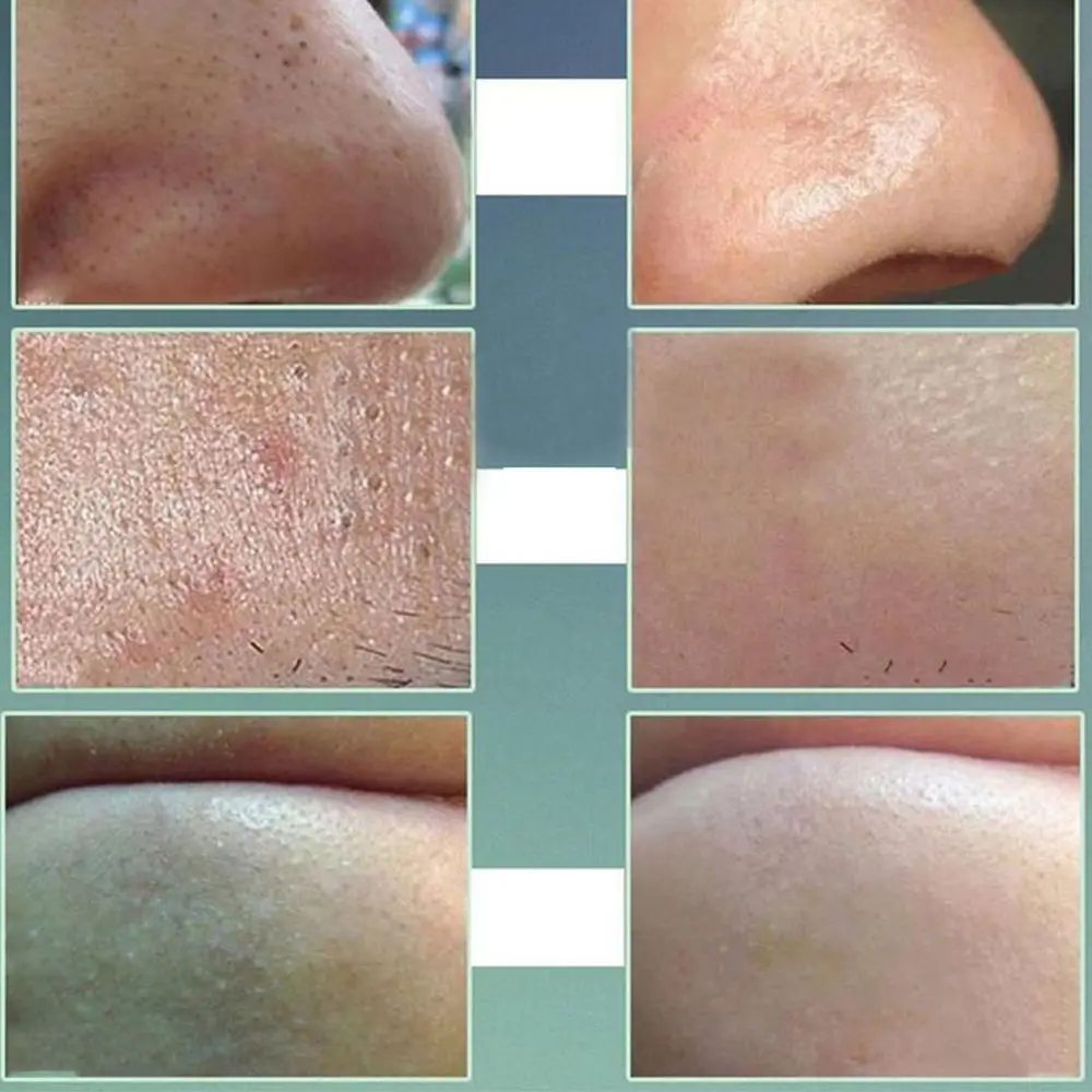1 шт. вулканической черная грязевая маска для лица Blackhead удаление Глубокая чистка лечение акне уход за кожей Красота Для женщин Лидер продаж