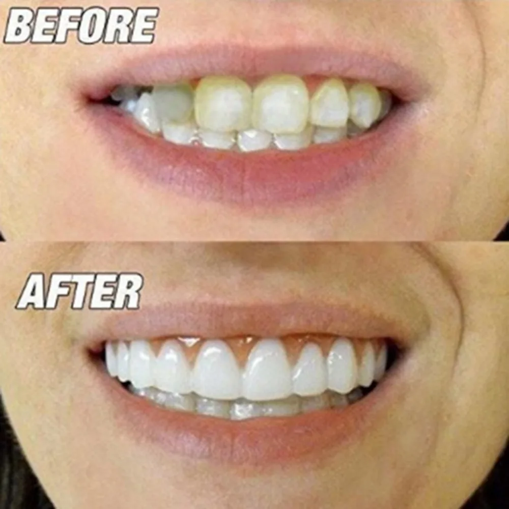 Натуральные силиконовые виниры Perfect Smile для мужчин и женщин, косметические виниры для ухода за зубами, инструмент для отбеливания зубов