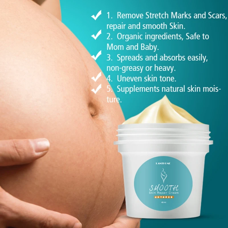 

Precious Face And Body Cream Scar Stretch Mark Remover Powerful From Postpartum Full Cream For Pregnant Women Skin Care