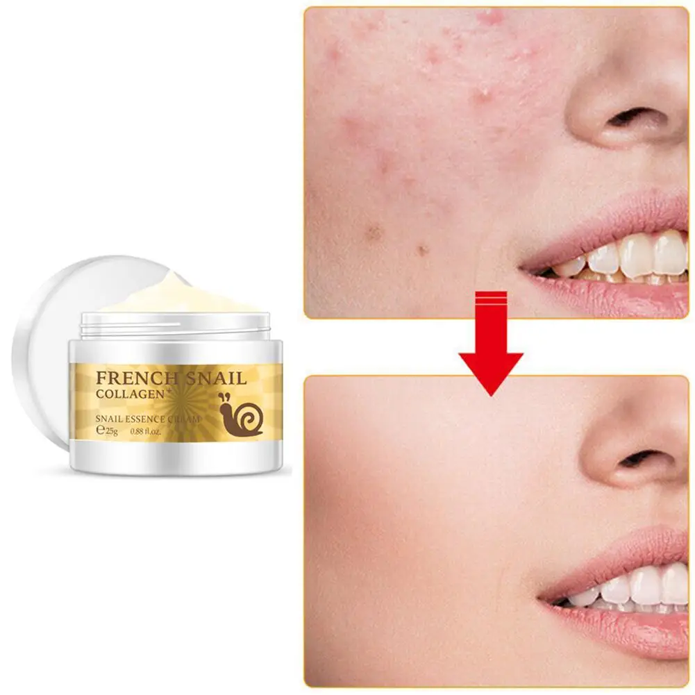 

Health Snail Face Cream Hyaluronic Acid Moisturizer anti Wrinkle collagen day cream skin care Anti Aging Nourishing Serum