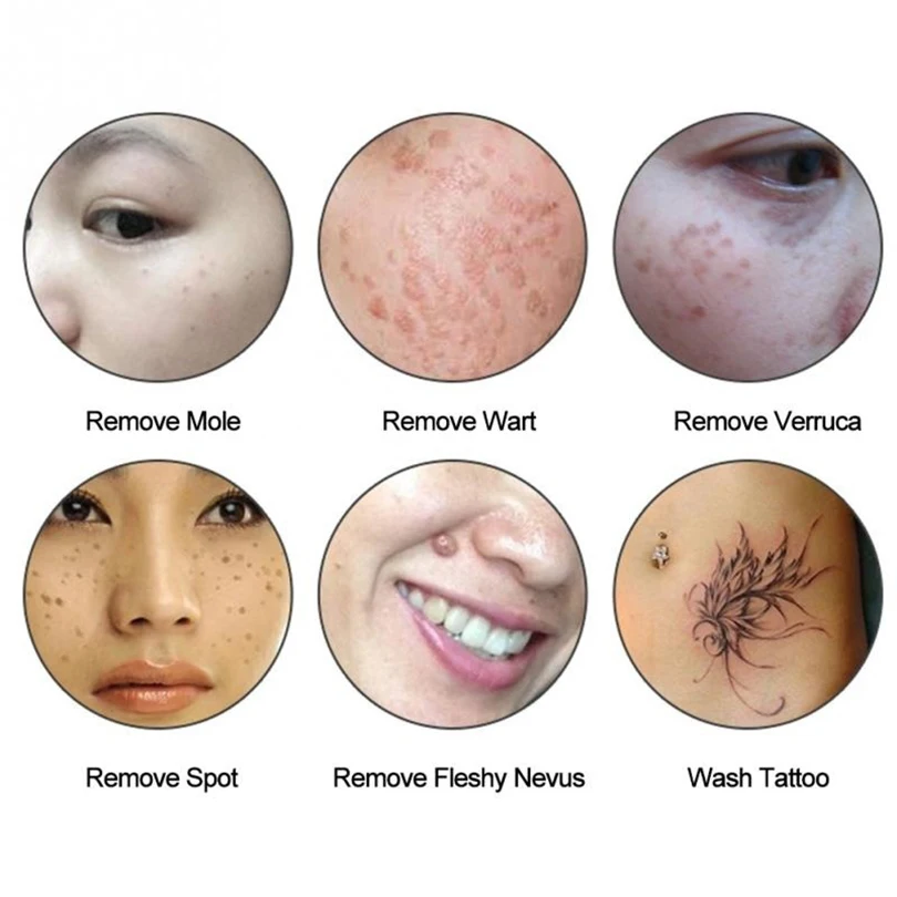 Довольно видеть Pro ультразвуковой микроциркуляцию кожи против старения