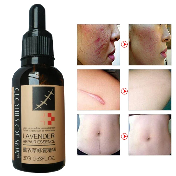 30 г удаление рубцов стрейч эфирное масло лаванды корректор пигментных пятен