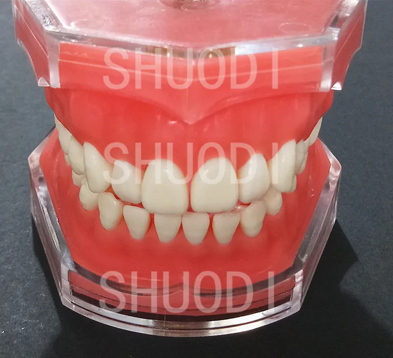 A tooth removable Стоматологическая Исследование Учебная модель стоматологического Стандартный модель съемные зубы для взрослых и детей TYPODONT модель Стоматолог Связь модель - Цвет: A tooth removable