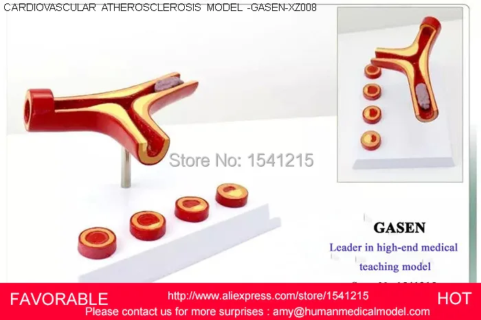 Анатомическая сосудистая атеросклерозная патология человека медицинский орган