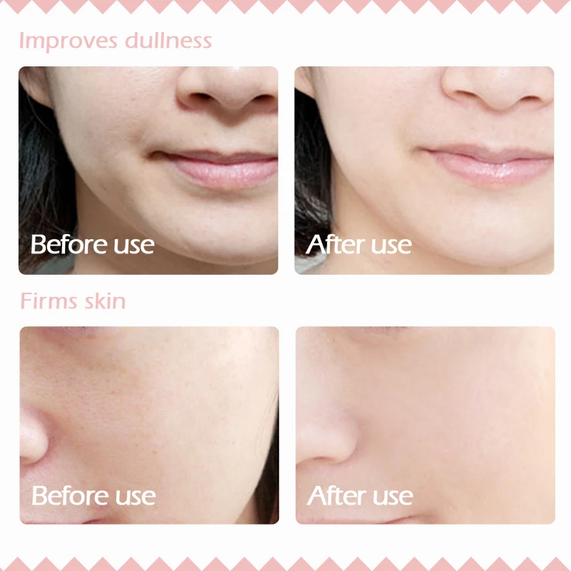 ТОЛЬКО ЧИСТЫЙ Красный Женьшень Улитка Увлажняющий Лосьон Уход За Кожей Лица