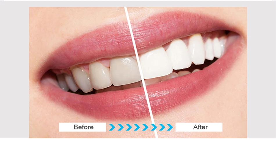 20 мешков/коробок или 10 мешков/NoBox Crest 3D Whitestrips профессиональные эффекты гель для отбеливания зубов Гигиена полос полости рта Отбеливание зубов