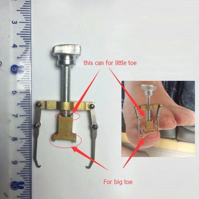 Устройство для фиксации вросших ногтей Adomaner ортопедический носок