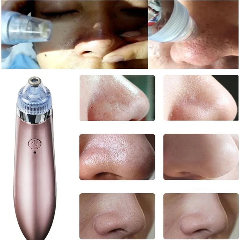 

Electric Facial Pore Cleaner Nose Blackhead face Cleansing pustule Acne Remover Vacuum Comedo Suction Facial Cleaning Skin Care
