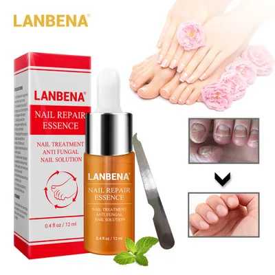 LANBENA nail repair essence serum Nail treatment of the fungus remove Onychomycosis feet nourishing brightening hand and foot ca |