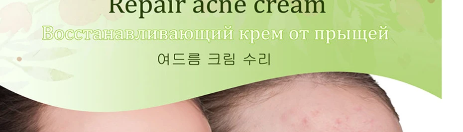 99% алоэ успокаивающий гель для кожи с алоэ вера уход удаляет мыло от акне увлажняющее мыло для тела и лица солнцезащитное алоэ гель 85 г
