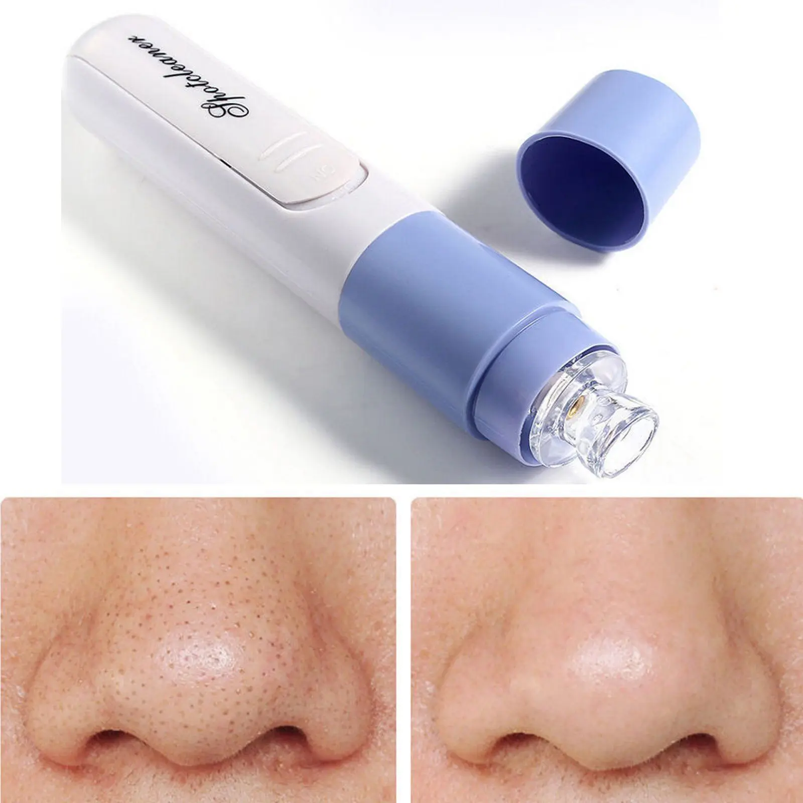 Очищающее средство для очистки пор кожи лица маска от черных точек удаления