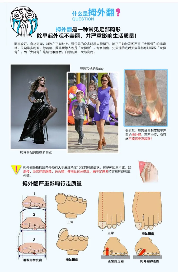 1 пара инструмент для ухода за ногами разделитель пальцев при захождении пальцев друг на друга лечение лечения вальгусные подтяжки ноги кости ортопедическое средство