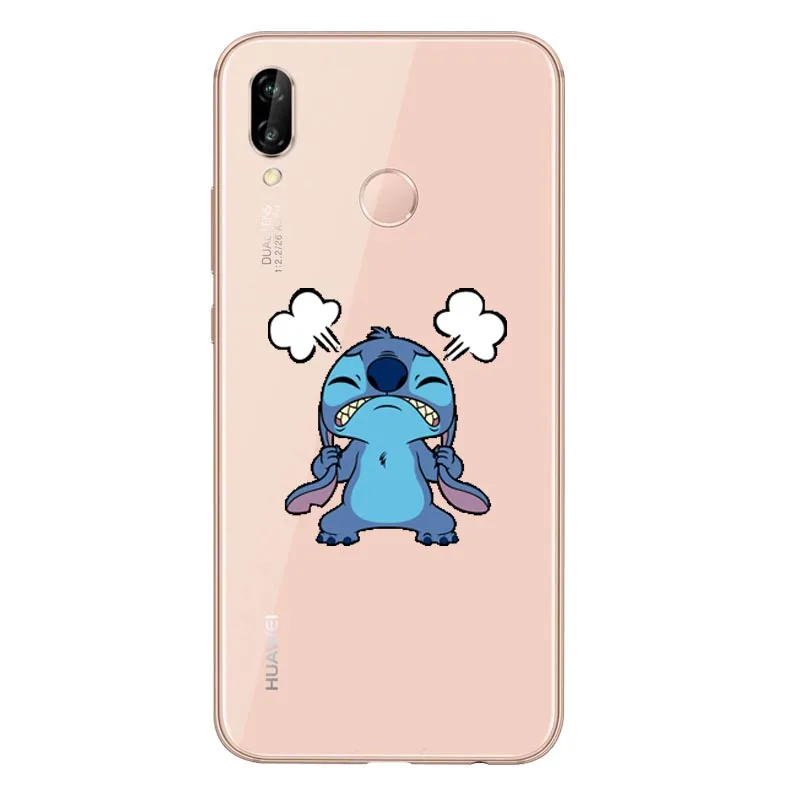 Забавный чехол для стежка мягкий из ТПУ телефона красного риса NOTE5pro Xiaomi MI 6PLUS 8 5