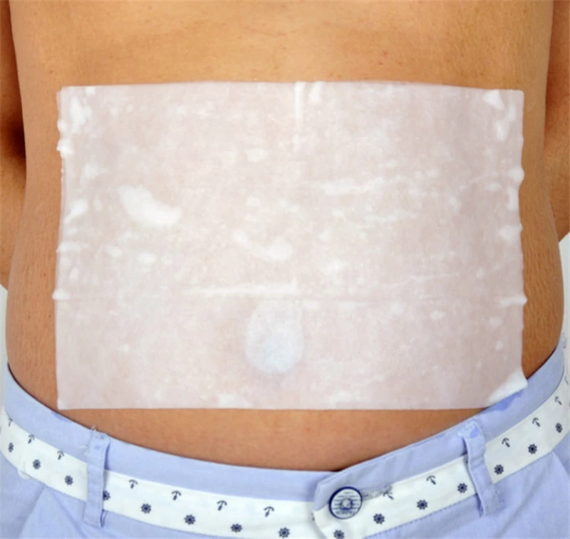 50pcs Anti Freeze Membranes Cryo Pad Bag Antifreeze Membran For Cold Therapy
